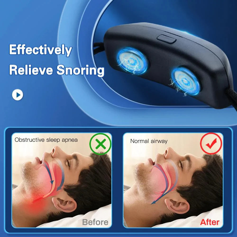 Dispositif Anti-Ronflement Intelligent EMS